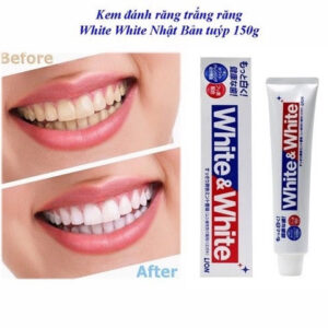 Combo 3 Kem Đánh Răng White And White Nhật Bản 3x150g (Tặng 3 Bàn Chải Đánh Răng)