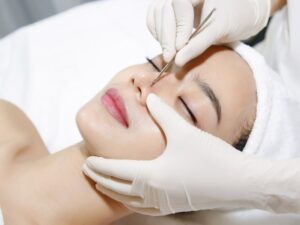 Liệu Trình Điều Trị Mụn Cơ bản Nikibi Chiryou SAKURA Clinic & Spa