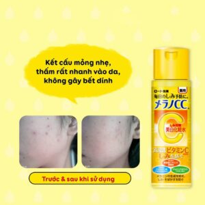 Nước hoa hồng CC Melano Rohto Lotion trắng da trị thâm nám tàn nhang 170ml ( loại nhiều ẩm)- mới nhất 2021