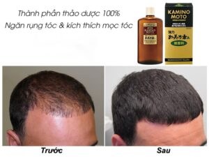 TINH DẦU DƯỠNG KÍCH THÍCH MỌC TÓC KAMINOMOTO 200ML - Hàng Nhật nội địa