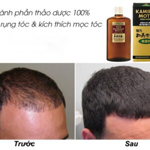 TINH DẦU DƯỠNG KÍCH THÍCH MỌC TÓC KAMINOMOTO 200ML - Hàng Nhật nội địa